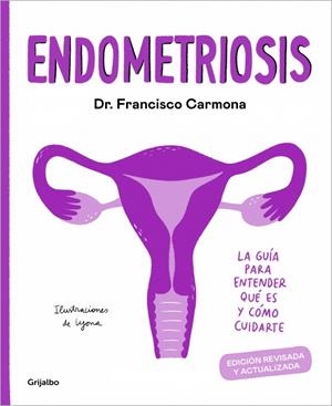 Endometriosis | 9788417752651 | Carmona, Dr. Francisco / Lyona